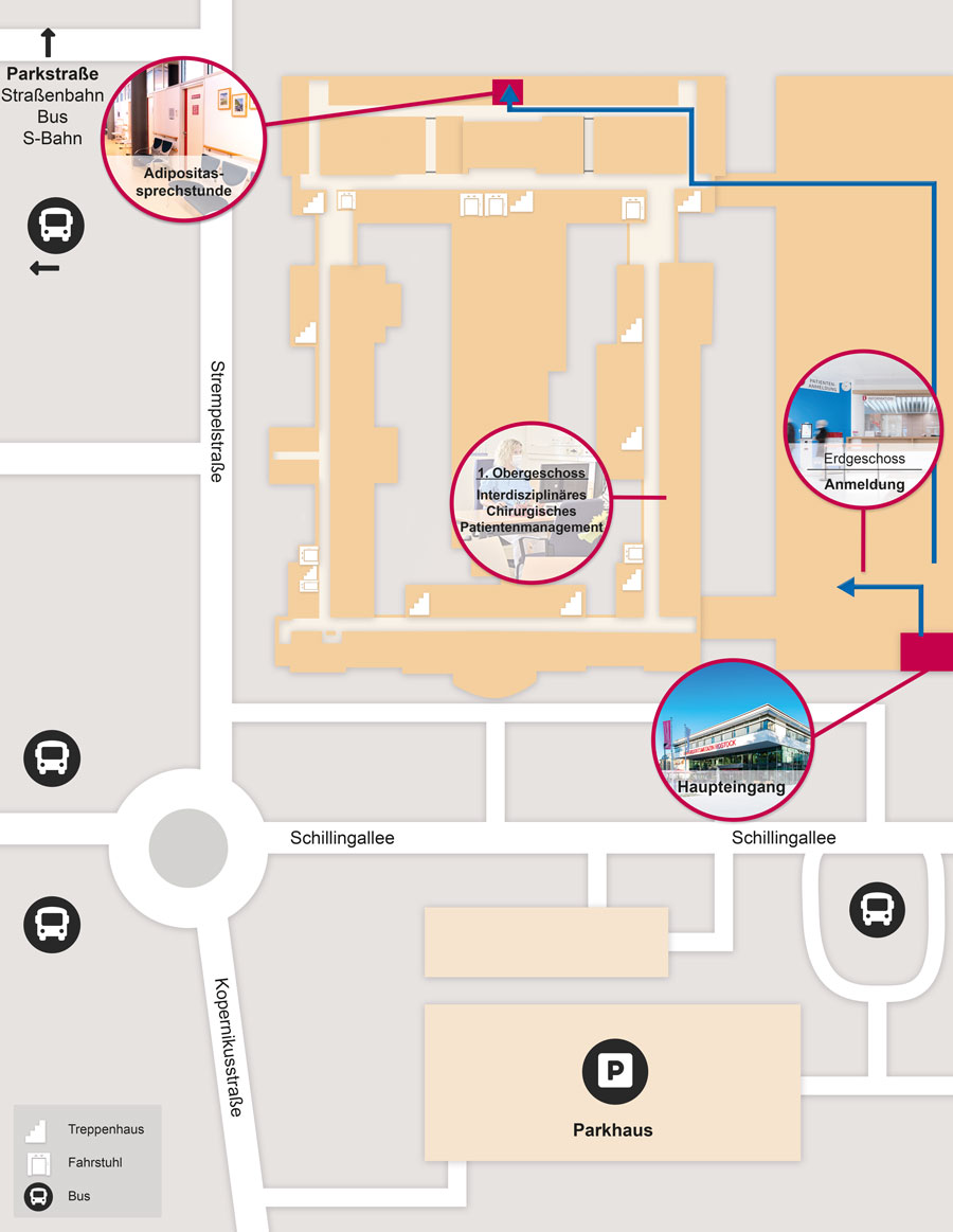 Anfahrtsskizze Adipositaszentrum Universitätsmedizin Rostock